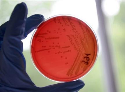 Καλλιέργεια μικροβίων σε τρυβλίο Πετρί. Όπως φαίνεται, η μέθοδος δεν ανιχνεύει όλα τα βακτήρια της ουροδόχου κύστης. (Φωτογραφία: ΑΠΕ)