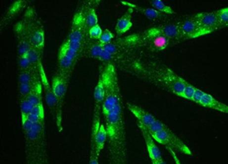 Βλαστικά κύτταρα επιζούν στους μυς πολύ μετά το θάνατο των υπόλοιπων ιστών -εικόνα αρχείου  