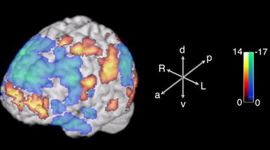 Τρισδιάστατη εικόνα από μαγνητικό τομογράφο δείχνει την εγκεφαλική δραστηριότητα που συνδέεται με τον αυθόρμητο μουσικό αυτοσχεδιασμό των μουσικών της jazz. Πηγή: eductaion.jhu.edu