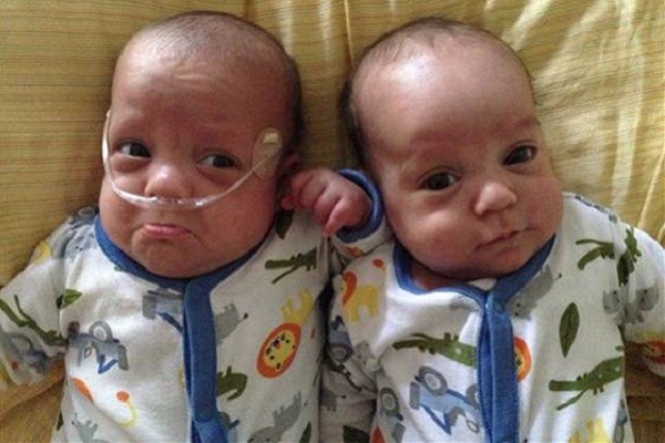 Τα πανομοιότυπα δίδυμα Carl και David που γεννήθηκαν με 39 ημέρες διαφορά